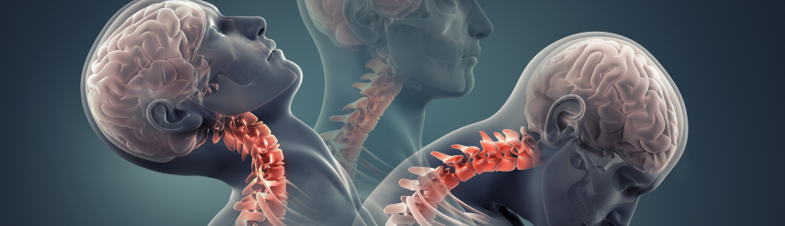 Understanding the Link between Concussions and Neck Pain