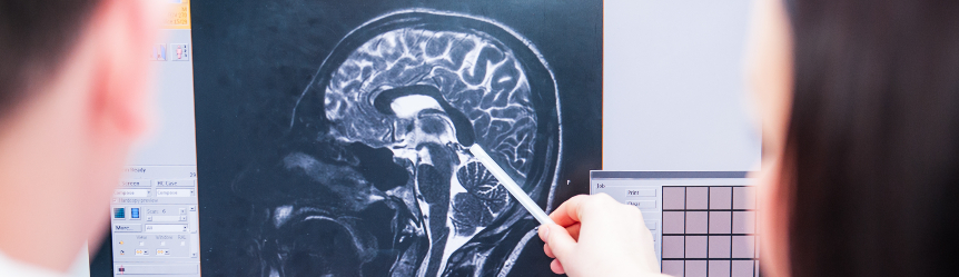 Can Your Personality Change after a Traumatic Brain Injury?