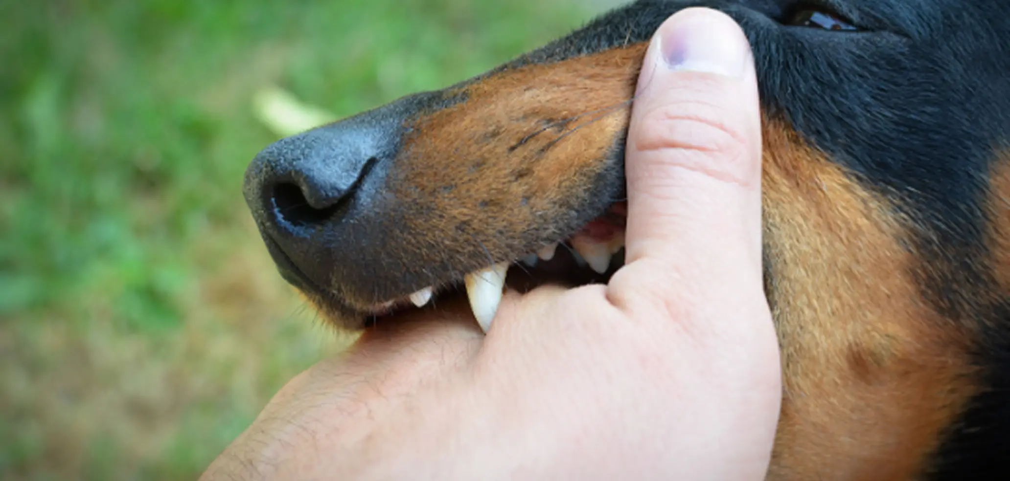 Dog-bite